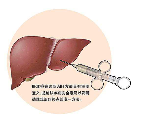 曝港姐亡夫曾因肝病一夕衰老 愿逝者安息