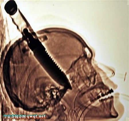 世界上不可思议的恶心记录:1分钟吃36只蟑螂 世界上不可思议的恶心记录:1分钟吃36只蟑螂