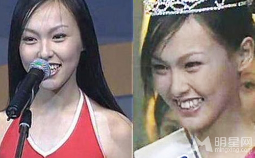 ���̾��մ�¶���� �����˯���ţ�