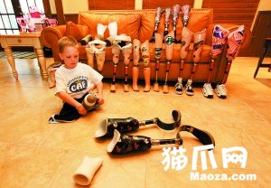 英残疾男孩备20副假肢参赛期待夺金 英残疾男孩备20副假肢参赛期待夺金