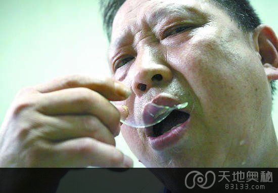 什么都敢吃!全球五花八门的异食癖者 什么都敢吃!全球五花八门的异食癖者