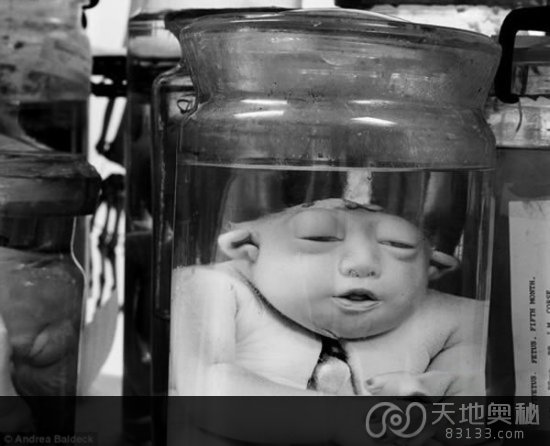 重口味慎入!超恐怖法国畸形博物馆 重口味慎入!超恐怖法国畸形博物馆