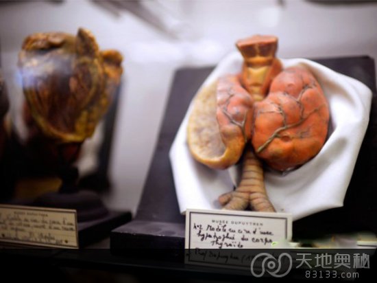 重口味慎入!超恐怖法国畸形博物馆 重口味慎入!超恐怖法国畸形博物馆